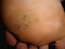 Before treatment